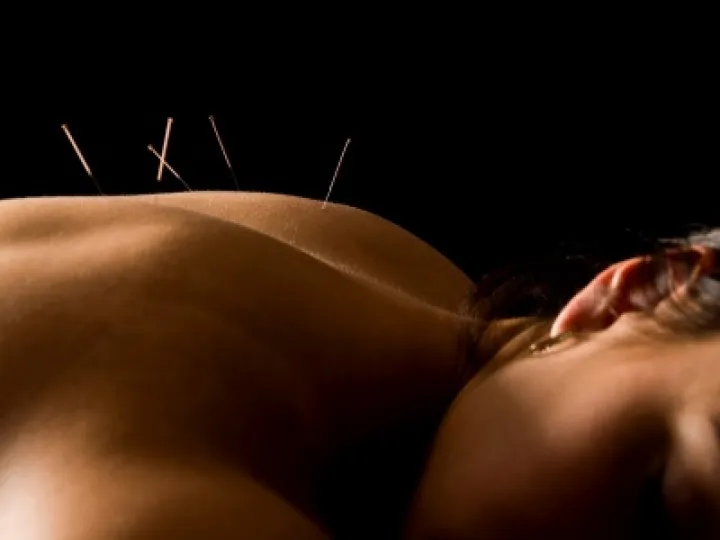 Acupunture