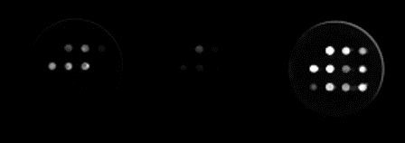 Figure 1: Images from three individual testing wells showing individual antigen spots that have bound antibody and are luminescent. This light is measured to produce a quantitative result as in Table 1.